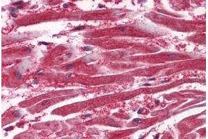 Anti-VEGFR-1 antibody IHC staining of human heart. (FLT1 抗体  (AA 1251-1338))