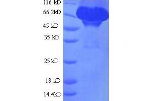 SDS-PAGE (SDS) image for Albumin (ALB) (AA 25-608) protein (His tag) (ABIN5713210)