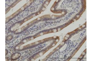 Immunoperoxidase of monoclonal antibody to CSNK1G1 on formalin-fixed paraffin-embedded human small Intestine. (CSNK1G1 抗体  (AA 293-393))