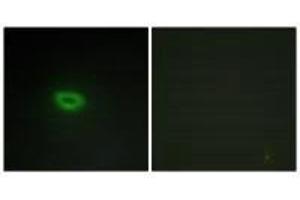 Immunofluorescence analysis of A549 cells, using ECRG4 antibody. (MEMO1 抗体)