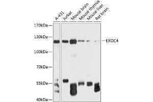 Western blot analysis of extracts of various cell lines, using EXOC4 antibody (ABIN6127883, ABIN6140366, ABIN6140367 and ABIN6215986) at 1:3000 dilution. (Sec8 抗体  (AA 1-280))