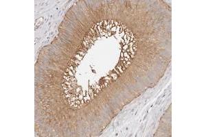 Immunohistochemical staining of human epididymis with TTLL4 polyclonal antibody  shows moderate cytoplasmic and membranous positivity in glandular cells. (TTLL4 抗体)