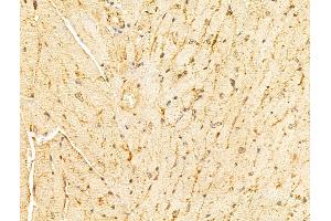 ABIN6265995 and ABIN6273344 at 1/100 staining Mouse heart tissue by IHC-P.