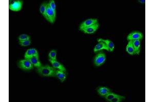 Immunofluorescence staining of HepG2 cells with ABIN7163983 at 1:66, counter-stained with DAPI. (Kcne3 抗体  (AA 1-57))