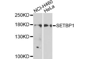 Western blot analysis of extracts of NCI-H460 and HeLa cells, using SETBP1 antibody. (SETBP1 抗体)