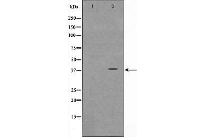 Western blot analysis on Jurkat cell lysate using NT5C3 Antibody,The lane on the left is treated with the antigen-specific peptide. (NT5C3 抗体  (N-Term))