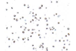 Immunocytochemistry (ICC) image for anti-Ubiquitin-Like, Containing PHD and RING Finger Domains, 1 (UHRF1) (AA 1-50) antibody (ABIN7795824)