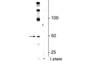Western blot of mouse hippocampal lysate showing specific immunolabeling of the ~50 kDa eEF1A2 protein phosphorylated at Ser358 in the first lane (-). (EEF1A2 抗体  (pSer358))