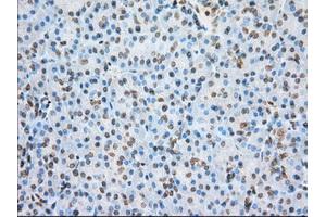 Immunohistochemical staining of paraffin-embedded colon tissue using anti-ERCC1 mouse monoclonal antibody. (ERCC1 抗体)