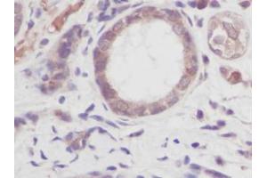 Image no. 1 for anti-Tumor Necrosis Factor alpha (TNF alpha) antibody (ABIN465030) (TNF alpha 抗体)