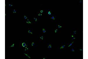 Immunofluorescence staining of SH-SY5Y cells with ABIN7166541 at 1:100, counter-stained with DAPI. (PCDHGB7 抗体  (AA 719-929))