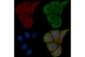 ABIN6259200 and ABIN6275528 staining Hela cells(45 min of heat-shock) by IF/ICC. (STK32C 抗体  (Internal Region))