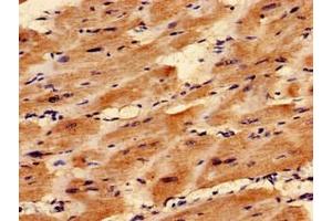 Immunocytochemistry analysis of human heart tissue using ABIN7171476 at dilution of 1:100 (TAZ 抗体  (AA 95-262))