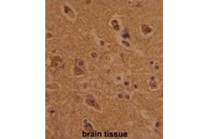 Immunohistochemistry (IHC) image for anti-CTD (Carboxy-terminal Domain, RNA Polymerase II, Polypeptide A) Phosphatase, Subunit 1 (CTDP1) antibody (ABIN3002722) (CTDP1 抗体)