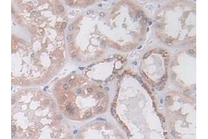 Detection of IDH2 in Human Kidney Tissue using Polyclonal Antibody to Isocitrate Dehydrogenase 2, mitochondrial (IDH2) (IDH2 抗体  (AA 40-452))