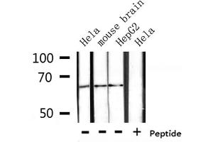 Western blot analysis of extracts from Hela, mouse brain, HepG2, using CTPS Antibody. (CTP Synthase 抗体  (C-Term))