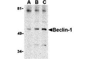 Western Blotting (WB) image for anti-Beclin 1, Autophagy Related (BECN1) (C-Term) antibody (ABIN1030289) (Beclin 1 抗体  (C-Term))