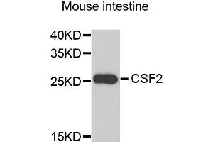 Western blot analysis of extracts of mouse intestine, using CSF2 antibody. (GM-CSF 抗体)