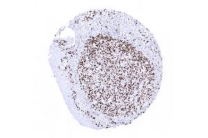 tonsil surface epithelium (Ki-67 抗体  (AA 2293-2478))