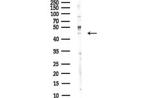 anti-WD Repeat Domain 73 (WDR73) antibody