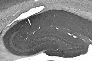 Adult rat hippocampus immunohistochemistry. (CNTNAP2 抗体  (Extracellular))