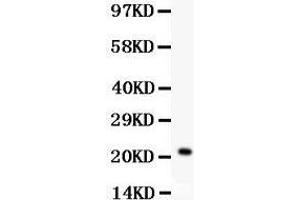 Anti- IL18 Picoband antibody, Western blotting All lanes: Anti IL18  at 0. (IL-18 抗体  (AA 36-192))