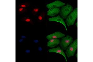 ABIN6263195 and ABIN6279528 staining  cells by IF/ICC. (MED29 抗体  (Internal Region))