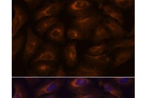 Immunofluorescence analysis of U-2 OS cells using GPR22 Polyclonal Antibody at dilution of 1:100. (GPR22 抗体)
