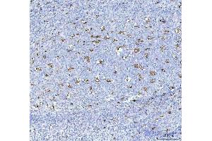 IHC analysis of CD68 using anti-CD68 antibody (ABIN7600142).