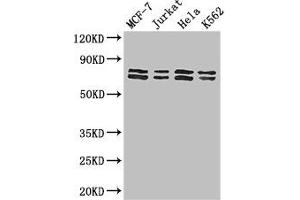 Western Blot Positive WB detected in: MCF-7 whole cell lysate, Jurkat whole cell lysate, Hela whole cell lysate, K562 whole cell lysate All lanes: TRIM25 antibody at 3 μg/mL Secondary Goat polyclonal to rabbit IgG at 1/50000 dilution Predicted band size: 71 kDa Observed band size: 71, 80 kDa (TRIM25 抗体  (AA 81-272))