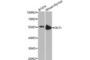 Western blot analysis of extracts of various cell lines, using DET1 antibody. (DET1 抗体  (AA 15-240))