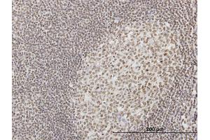 Immunoperoxidase of monoclonal antibody to IFI16 on formalin-fixed paraffin-embedded human tonsil. (IFI16 抗体  (AA 630-729))