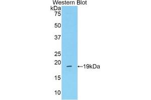 Western blot analysis of the recombinant protein. (Mannose Associated Serine Protease 2 (AA 280-433) 抗体)