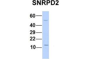 Host:  Rabbit  Target Name:  SNRPD2  Sample Type:  Human 293T  Antibody Dilution:  1. (SNRPD2 抗体  (N-Term))