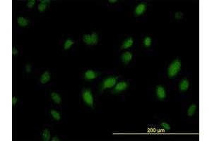 Image no. 3 for anti-RNA Guanine-7 Methyltransferase (RNMT) (AA 1-477) antibody (ABIN599057) (RNMT 抗体  (AA 1-477))