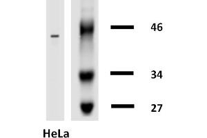 Western blotting analysis of human cytokeratin 18 using mouse monoclonal antibody DA-7 on lysates of HT-29 cell line and MOLT-4 cell line (cytokeratin non-expressing cell line, negative control) under non-reducing and reducing conditions. (Cytokeratin 18 抗体  (Biotin))
