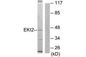 Western blot analysis of extracts from 293 cells, using EKI2 Antibody. (Ethanolamine Kinase 2 抗体  (AA 51-100))