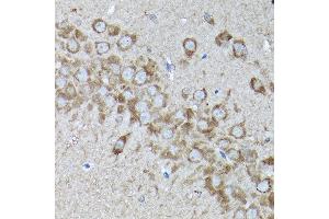 Immunohistochemistry of paraffin-embedded rat brain using SNAPIN Rabbit pAb  at dilution of 1:200 (40x lens). (SNAPIN 抗体  (AA 1-136))