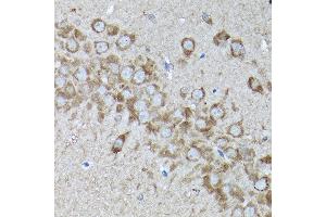 Immunohistochemistry of paraffin-embedded rat brain using SNAPIN Rabbit pAb  at dilution of 1:200 (40x lens).