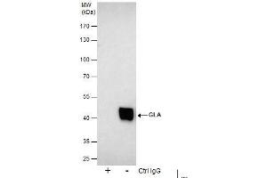 IP Image Immunoprecipitation of GLA protein from 293T whole cell extracts using 5 μg of Galactosidase alpha antibody [N1C2], Western blot analysis was performed using Galactosidase alpha antibody [N1C2], EasyBlot anti-Rabbit IgG  was used as a secondary reagent. (GLA 抗体)