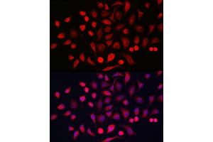 Immunofluorescence (IF) image for anti-Keratin 16 (KRT16) (AA 190-430) antibody (ABIN6143021)