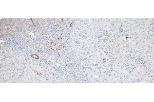 Immunohistochemistry of paraffin-embedded Rat ovary using Phospho-MYL9(T18/S19) Polyclonal Antibody at dilution of 1:100 (20x lens). (MYL9 抗体  (pSer19, pThr18))