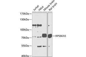 Western blot analysis of extracts of various cell lines, using RPS6K Antibody (699) at 1:1000 dilution. (MSK1 抗体  (AA 700-800))