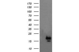 Image no. 1 for anti-NFKB Inhibitor Interacting Ras-Like 1 (NKIRAS1) antibody (ABIN1499743) (NKIRAS1 抗体)