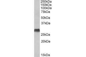 ABIN571247 (1µg/ml) staining of Human Bone Marrow lysate (35µg protein in RIPA buffer). (HLA-DQA2 抗体  (C-Term))