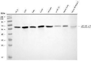 Western blot analysis of KLHL12 using anti-KLHL12 antibody (ABIN7601008).