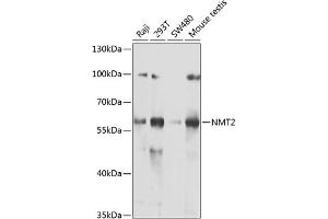 Western blot analysis of extracts of various cell lines, using NMT2 antibody (ABIN6130572, ABIN6144688, ABIN6144690 and ABIN6222825) at 1:1000 dilution. (NMT2 抗体  (AA 1-120))