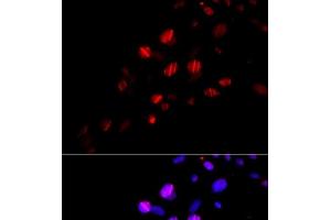Immunofluorescence analysis of U2OS cells using RAD18 Polyclonal Antibody (RAD18 抗体)
