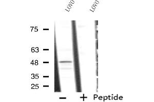 Western blot analysis of extracts from LOVO cells, using RAD23A antibody. (RAD23A 抗体  (C-Term))