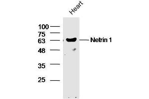 Mouse heart lysates probed with Rabbit Anti-Netrin 1 Polyclonal Antibody, Unconjugated  at 1:5000 for 90 min at 37˚C. (Netrin 1 抗体  (AA 501-604))
